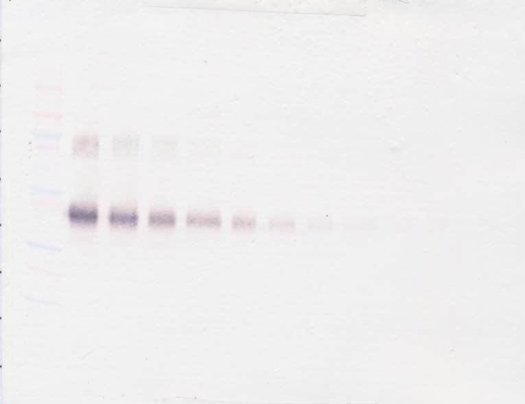 sIL-2 Receptor alpha Antibody
