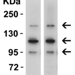 <strong>WB Validation  in Mouse and Rat Brain </strong><br> Loading: 15 µg of tissue lysate Antibodies:  CRB2 7155, 1 µg/mL , 1 h incubation at RT in 5% NFDM/TBST.Secondary: Goat Anti-Rabbit IgG HRP conjugate at 1:10000 dilution.