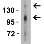 <strong>WB Validation  in Human Kidney</strong><br> Loading: 15 µg of tissue lysate Antibodies:  CRB2 7155, 1 µg/mL , 1 h incubation at RT in 5% NFDM/TBST.Secondary: Goat Anti-Rabbit IgG HRP conjugate at 1:10000 dilution.