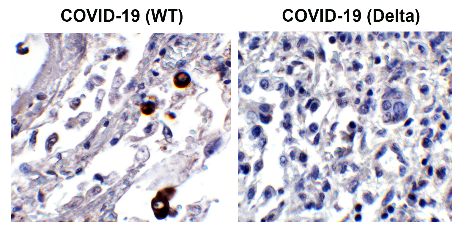 SARS-CoV-2 (COVID-19) Spike 156-157EF Antibody
