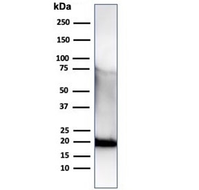 Recombinant His Tag Antibody / Histidine [r6HIS/6423]