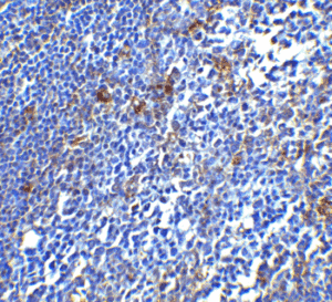 ProSci PD-1 Antibody (ProSci Cat #: 4065, Genesee Cat #: GS1-681) Immunohistochemistry Validation of PD-1in Human Tonsil Tissue