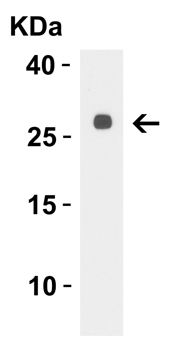 LpxT Antibody