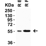<strong>Figure 5  WB Validation  in Rat Tissues </strong><br>Loading: 15 μg of rat tissue lysate Antibodies:  CRBN 8115, 0.5 μg/mL , 1 h incubation at RT in 5% NFDM/TBST. Secondary: Goat anti-rabbit IgG HRP conjugate at 1:10000 dilution.