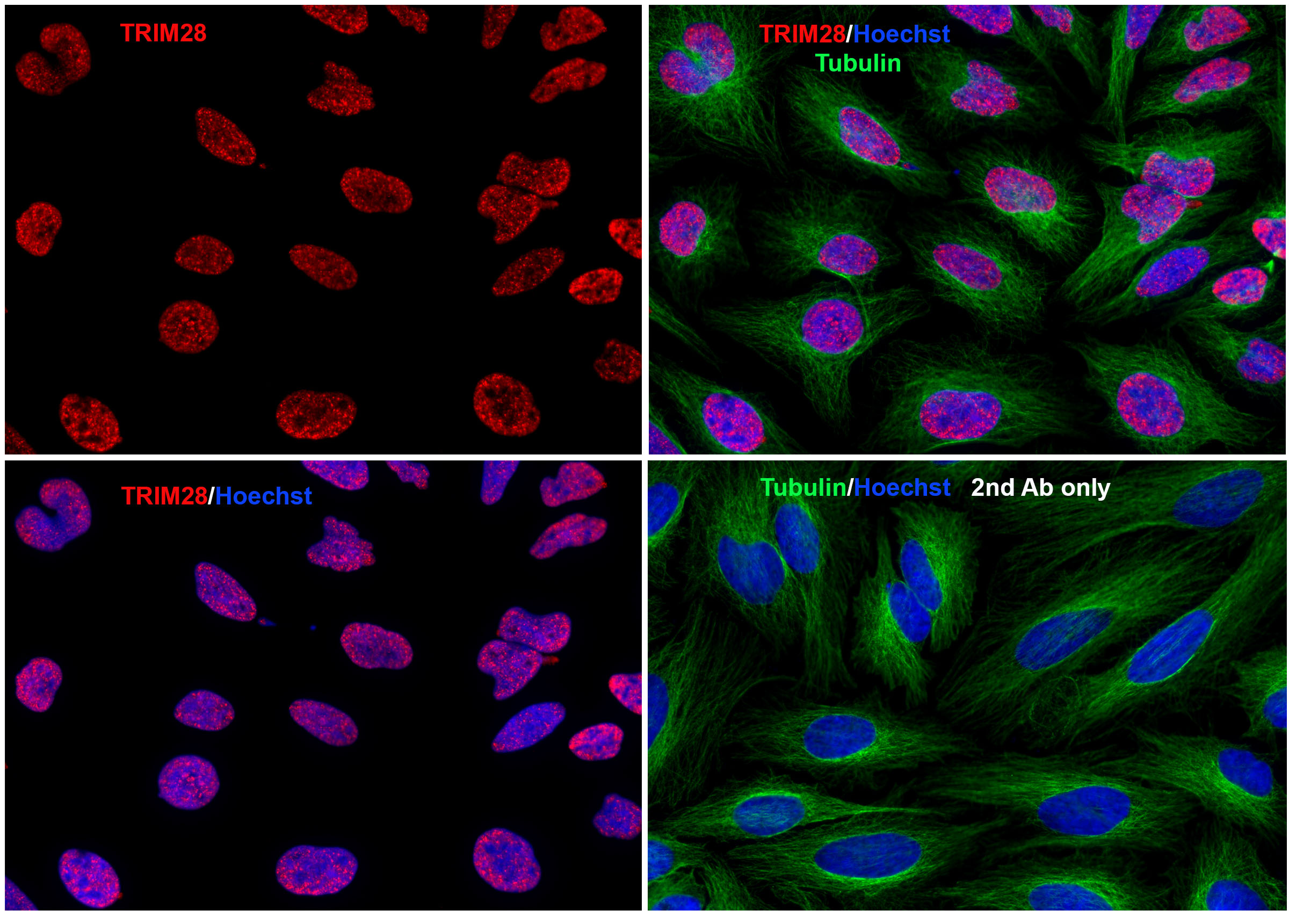 TRIM28 Antibody