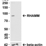 <strong>Figure 1. RHAMM KO Validation in HeLa Cells</strong><br>Loading: 10 μg of lysate Antibodies: XRHAMM 6189, 1 μg/mL and beta-actin 3779-1301, 1μg/mL, 1 h incubation at RT in 5% NFDM/TBST. Secondary: Goat Anti-Rabbit IgG HRP conjugate at 1:10000 dilution.