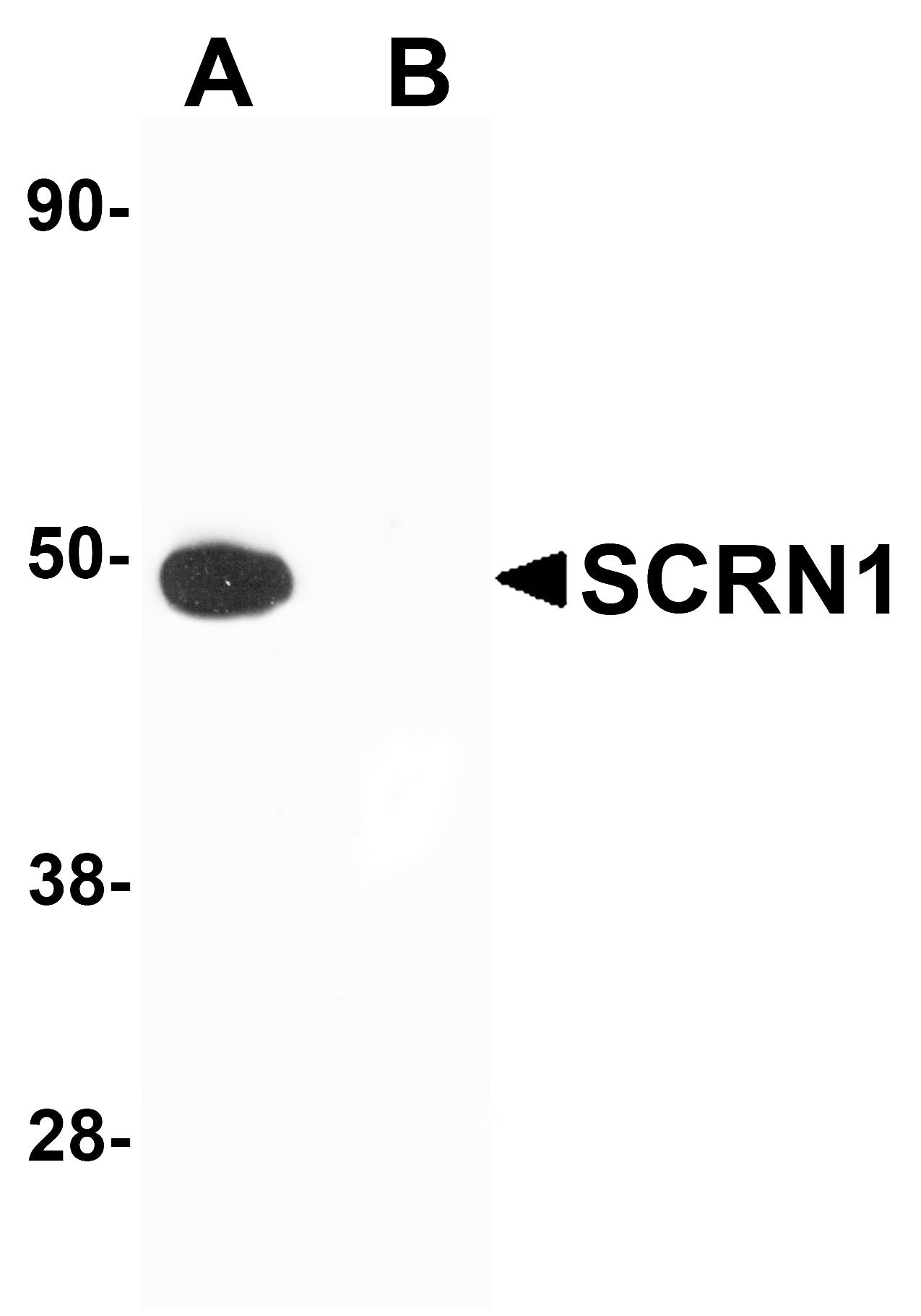 SCRN1 Antibody