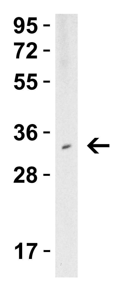 TMIGD2 Antibody