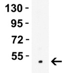 <strong>Figure 4 Western Blot Validation in Rat Skeletal Muscle </strong><br>Loading: 10 μg of lysates per lane.Antibodies: LMX1A, 7087, 1 μg/mL, 1h incubation at RT in 5% NFDM/TBST.Secondary: Goat anti-rabbit IgG HRP conjugate at 1:10000 dilution.