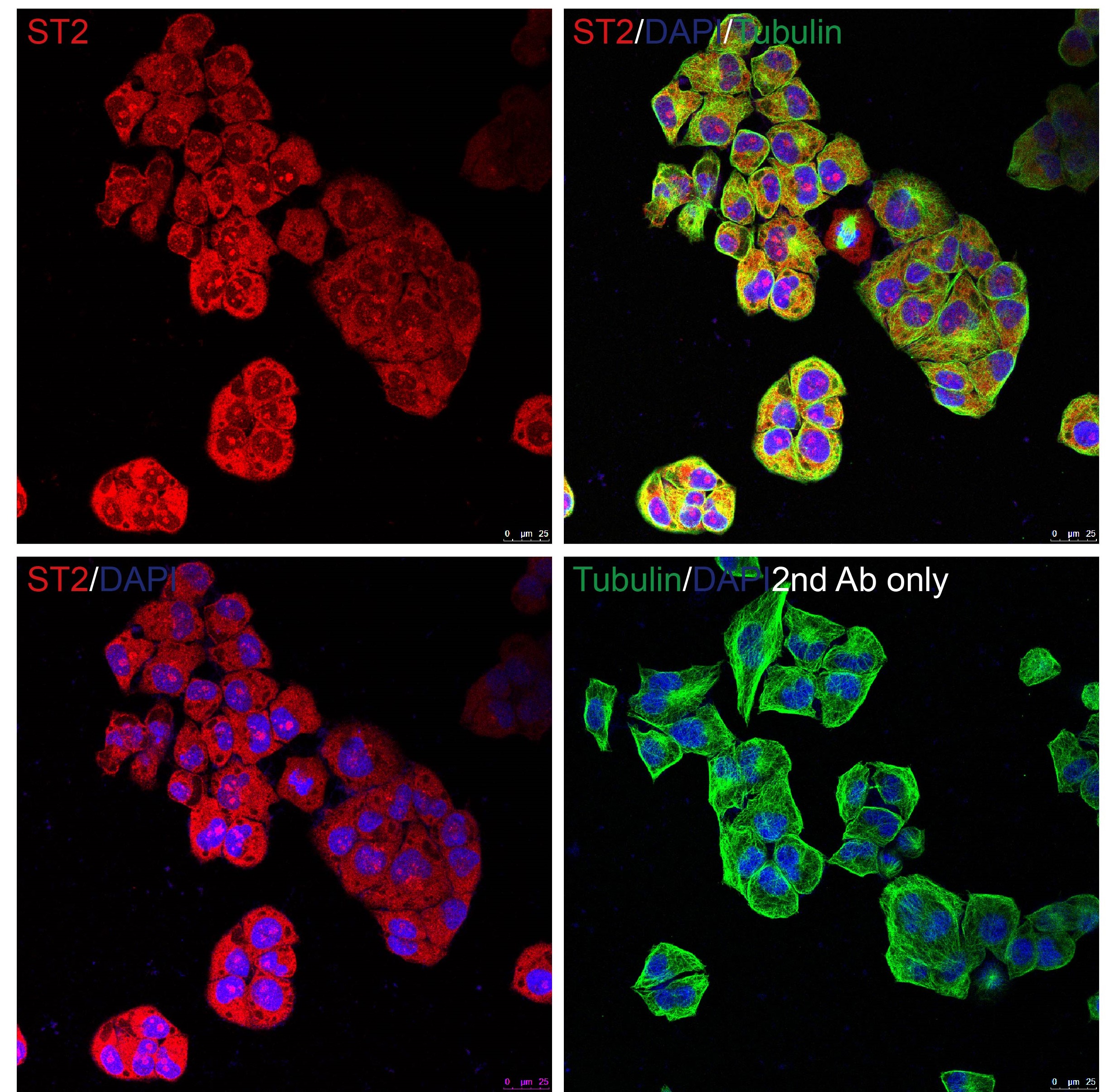 ST2 Antibody