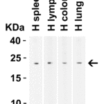 <strong> Figure 1 WB Validation  in Human Tissues</strong><br>Loading: 10 μg of lysate Antibodies:  BCMA, 2397, 2 μ g/mL, 1 h incubation at RT in 5% NFDM/TBST. Secondary: Goat Anti-Rabbit IgG HRP conjugate at 1:10000 dilution.