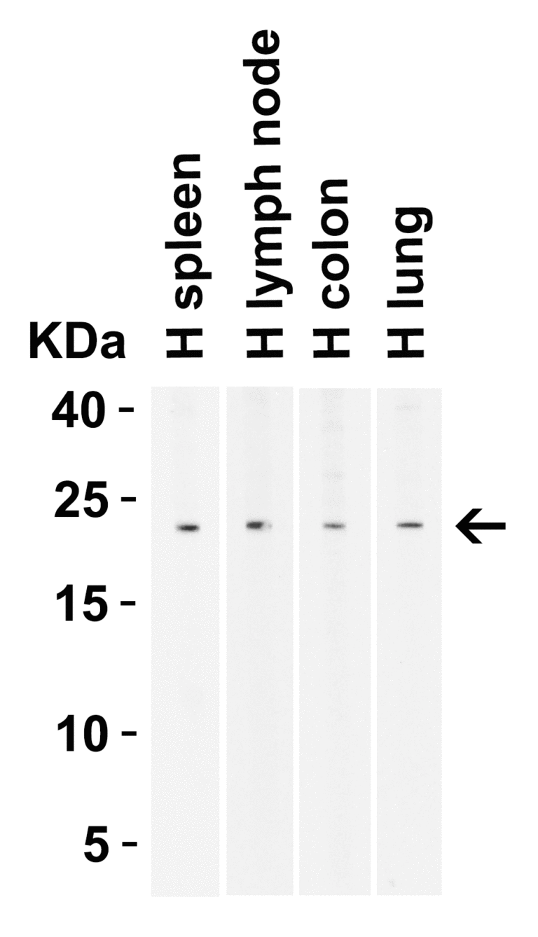 BCMA Antibody