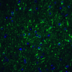 <strong>Figure 9 Immunofluorescence Validation of Beclin-1 in Mouse Brain Tissue</strong><br>Immunofluorescent analysis of 4% paraformaldehyde-fixed mouse brain labeling Beclin-1 with 3613 at 20 g/mL, followed by goat anti-rabbit IgG secondary antibody at 1/500 dilution (green) and DAPI antibody (blue).