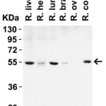 <strong>Figure 4 WB Validation  in Rat Tissues</strong><br>  Loading: 15 μg of lysate Antibodies:  Beclin-1 3613, 1 μg/mL , 1 h incubation at RT in 5% NFDM/TBST. Secondary: Goat Anti-Rabbit IgG HRP conjugate at 1:10000 dilution.