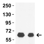 <strong>Figure 2 WB Validation  in Mouse and Rat Brain </strong><br>Loading: 15 μg of lysate Antibodies:  GLS2, 6217, 1 μg/mL , 1 h incubation at RT in 5% NFDM/TBST. Secondary: Goat Anti-Rabbit IgG HRP conjugate at 1:10000 dilution.