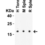 <strong>Figure 1 Western Blot Validation in Human, Mouse and Rat Tissues</strong><br>Loading: 15 µg of lysates per lane.Antibodies: IL-21 2465, (1 μg/mL), 1h incubation at RT in 5% NFDM/TBST.Secondary: Goat anti-rabbit IgG HRP