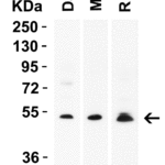 <strong> Figure 1 WB Validation  in Human, Mouse and Rat Samples</strong><br>Loading: 15 μg of lysate Antibodies:  RKHD4, 4869, 2 μ g/mL, 1 h incubation at RT in 5% NFDM/TBST. Secondary: Goat Anti-Rabbit IgG HRP conjugate at 1:10000 dilution.