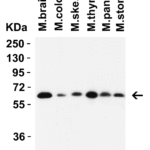 <strong>Figure 5 Western Blot Validation in Mouse Tissues</strong><br>Loading: 15 µg of lysates per lane.Antibodies: SQSTM1 5449 (1 μg/mL),  1h incubation at RT  in 5% NFDM/TBST.Secondary: Goat anti-rabbit IgG HRP conjugate at 1:10000 dilution.