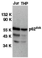 DOK1 Antibody