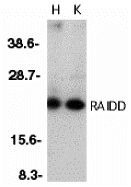 RAIDD Antibody