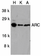 ARC Antibody