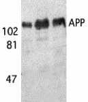 Western blot analysis of APP in (A) human, (B) mouse, and (C) rat brain tissue lysates with APP antibody at 1 μg/mL.
