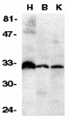 DcR3 Antibody