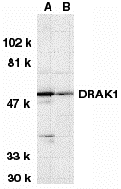 DRAK1 Antibody