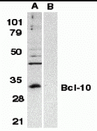 Bcl-10 Antibody