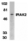 IRAK-2 Antibody