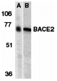 BACE2 Antibody