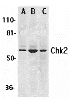 Chk2 Antibody