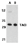 TACI Antibody