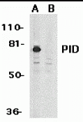 PID Antibody