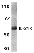 IL-21 Receptor Antibody
