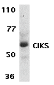 CIKS Antibody