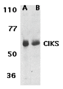 CIKS Antibody