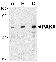 PAK6 Antibody