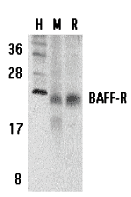 BAFF Receptor Antibody