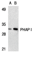 PHAP I Antibody