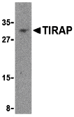 TIRAP Antibody