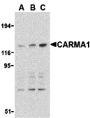 CARMA1 Antibody