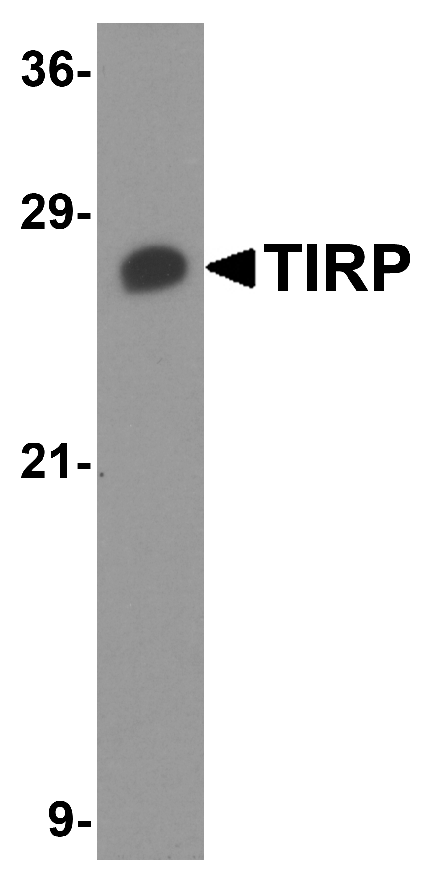 TIRP Antibody