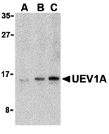 UEV1A Antibody