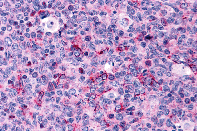 Caspase-3 Antibody