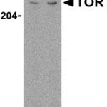Western blot analysis of TOR in L1210 cell lysate with TOR antibody at (A) 1 and (B) 2 μg/mL.