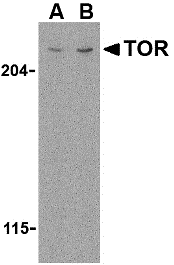 TOR Antibody