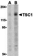 TSC1 Antibody