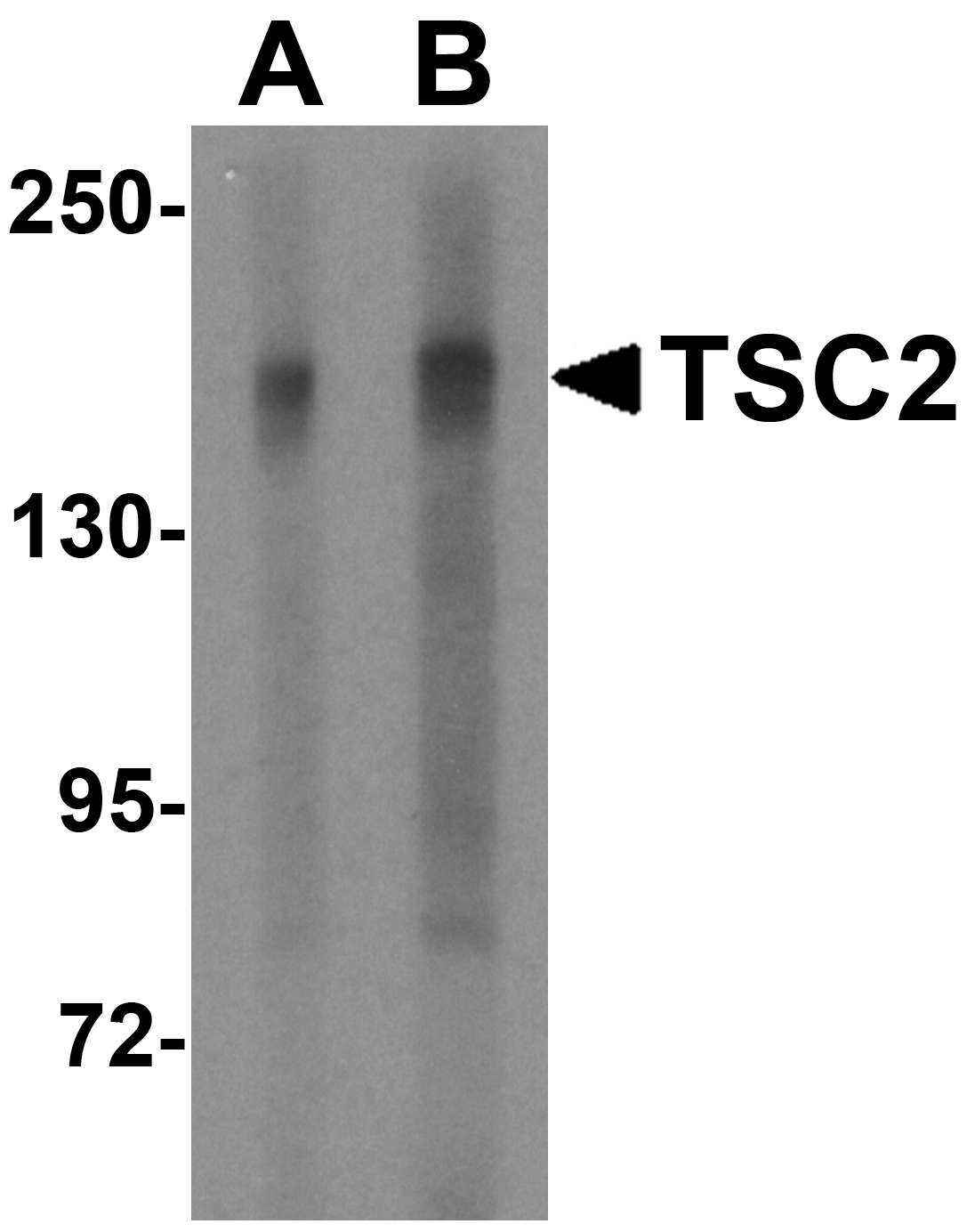 TSC2 Antibody