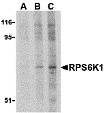 RPS6K1 Antibody